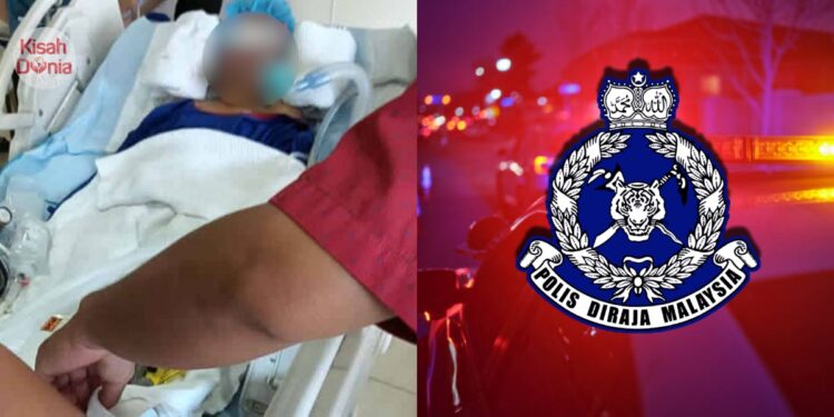 Tercampak Aras 3 Asrama Selepas Makan Mi Segera, Namun Perut Didapati Kosong