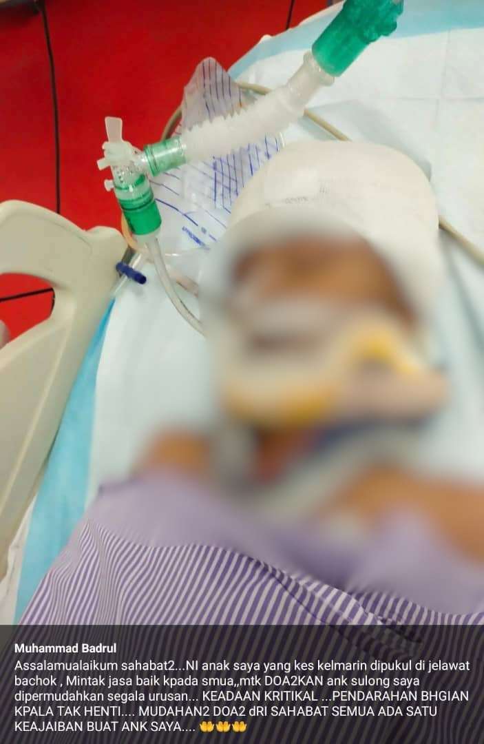 [BACHOK] Aniaya Anak Saudara, Lelaki Kemudian Tamatkan Hayat Diri Di Pokok Rhu