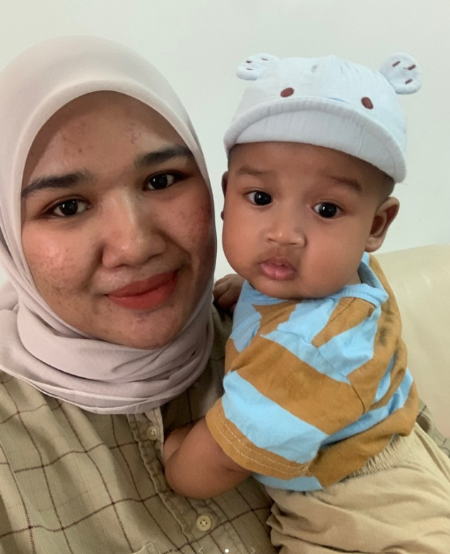 Bayi Terjatuh Dari Baby Bouncer Pergi Selamanya “3X Gugur, Dia Anak Sulung Kami”