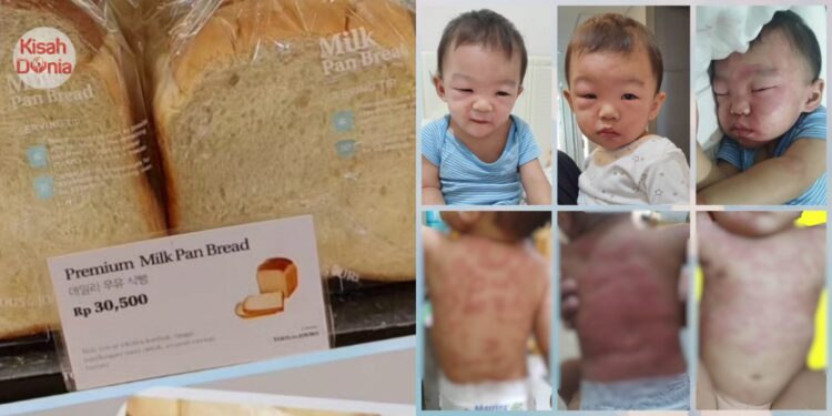 Bakeri Jual Roti Gluten-Free Rupanya Menipu, Anak Pelanggan Kena Alergi Serius