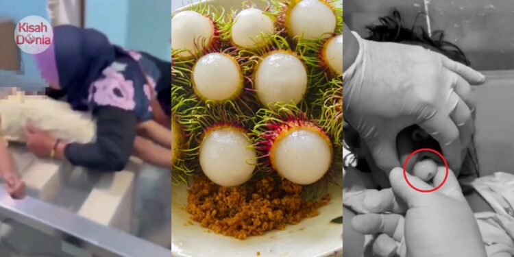 Tersedak Rambutan & Tak Sempat Diselamatkan, Ibu Ratapi Tubuh Kaku Anak 9 Tahun