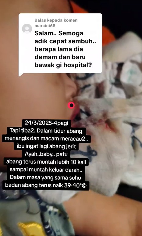 Alami Kerosakan Otak Akibat Influenza A, Anak Disahkan OKU Pada Usia 3 Tahun