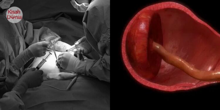 Doktor Terima Plastik Hitam Berisi Rahim Jam 2 Pagi, Uri Wanita Direntap Bidan