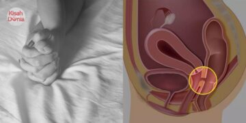 Najis Keluar Ikut Miss V, Isteri Curang Buat Benda Luar Tabii Dengan Lelaki Lain