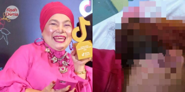 Datin Suzie Pinky Dikasari Anak Sendiri, Terima 5 Jahitan, Dada Dibaling Cawan