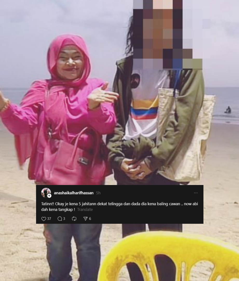Datin Suzie Pinky Dikasari Anak Sendiri, Terima 5 Jahitan, Dada Dibaling Cawan