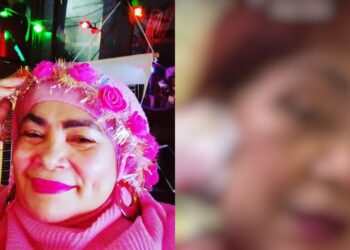 Datin Suzie Pinky Dikasari Anak Sendiri, Terima 5 Jahitan, Dada Dibaling Cawan