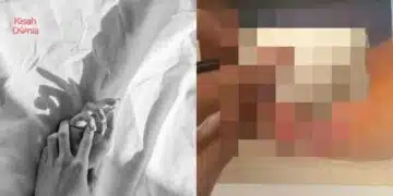 Gadis Umur 16 Kena Kutil Kelamin Di Miss & Belakang, BF Kaki ‘Pesta Songsang’