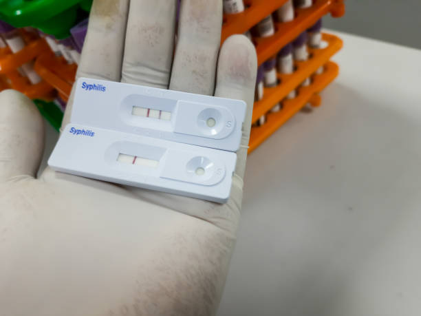 8 Bulan Abai Nafkah Batin, Doktor Rupanya ‘G’, Isteri Merana Dijangkiti Sifilis