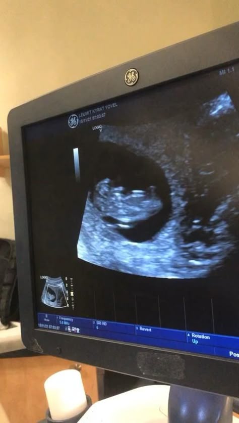 Nikahi Duda Anak 4, Isteri Disahkan Hamil Terkejut Suami Suruh Tanggung 100%