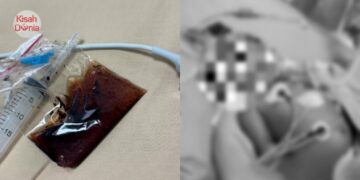 Bayi Usia 2 Bulan Cirit-Birit, Meninggal Dunia Selepas Diberi Minum Minyak Herba