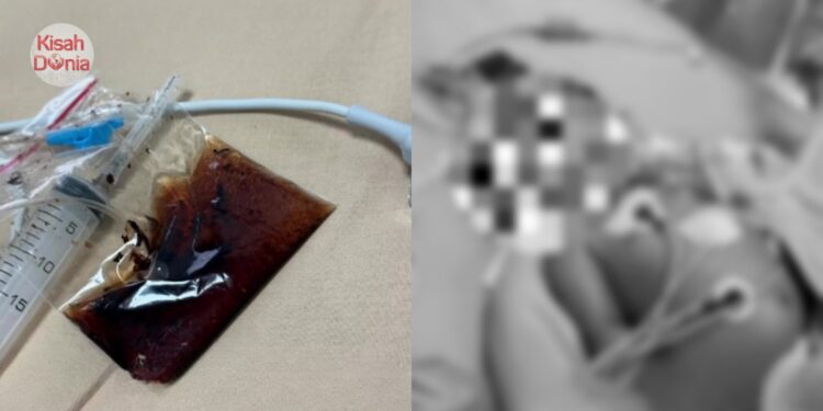 Bayi Usia 2 Bulan Cirit-Birit, Meninggal Dunia Selepas Diberi Minum Minyak Herba