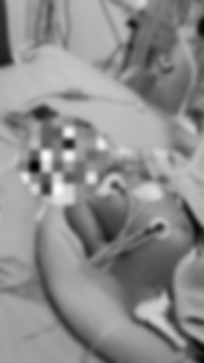 Bayi Usia 2 Bulan Cirit-Birit, Meninggal Dunia Selepas Diberi Minum Minyak Herba