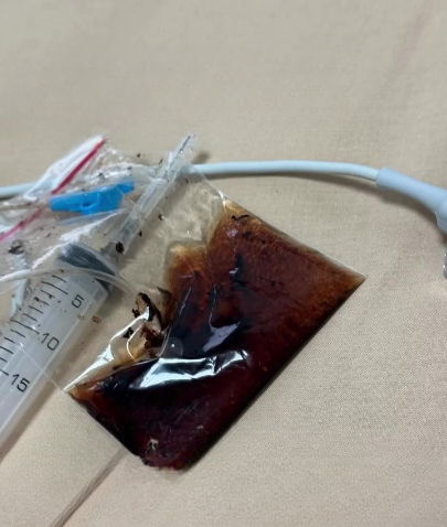 Bayi Usia 2 Bulan Cirit-Birit, Meninggal Dunia Selepas Diberi Minum Minyak Herba