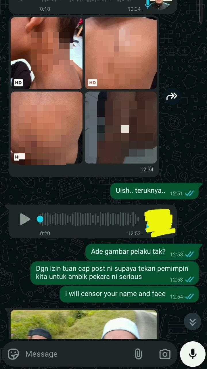 Rotan Bertalu-Talu Termasuk Leher, Warden Tahfiz Didakwa Bertugas Seperti Biasa