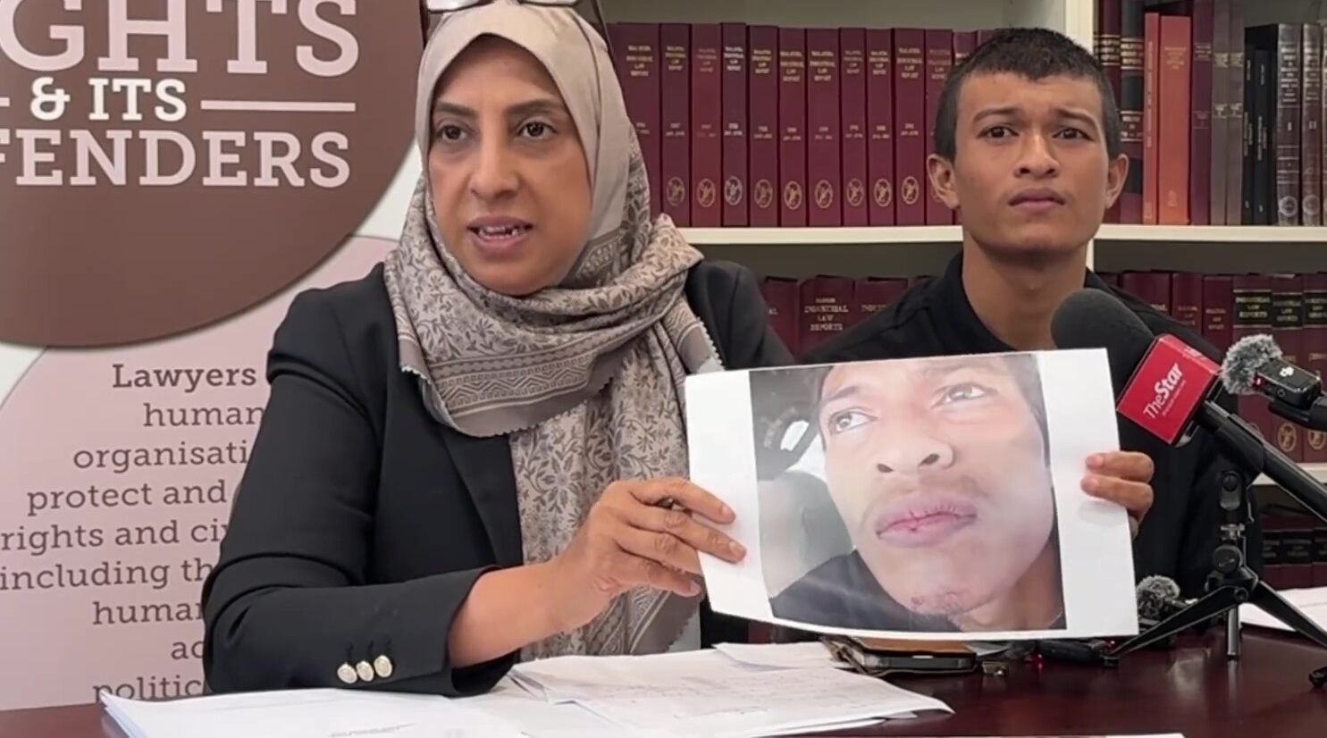 Disalah Anggap Sebagai Peragut, Pemuda Dianiaya Polis, Bibir Dicucuh Puntung