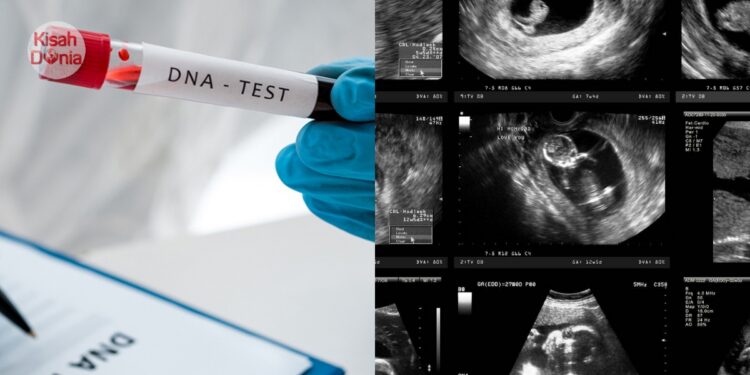 Ujian DNA Sahkan 5 Anak Bukan ‘Benih’ Kandung, Lelaki Rupanya Telan Kembar