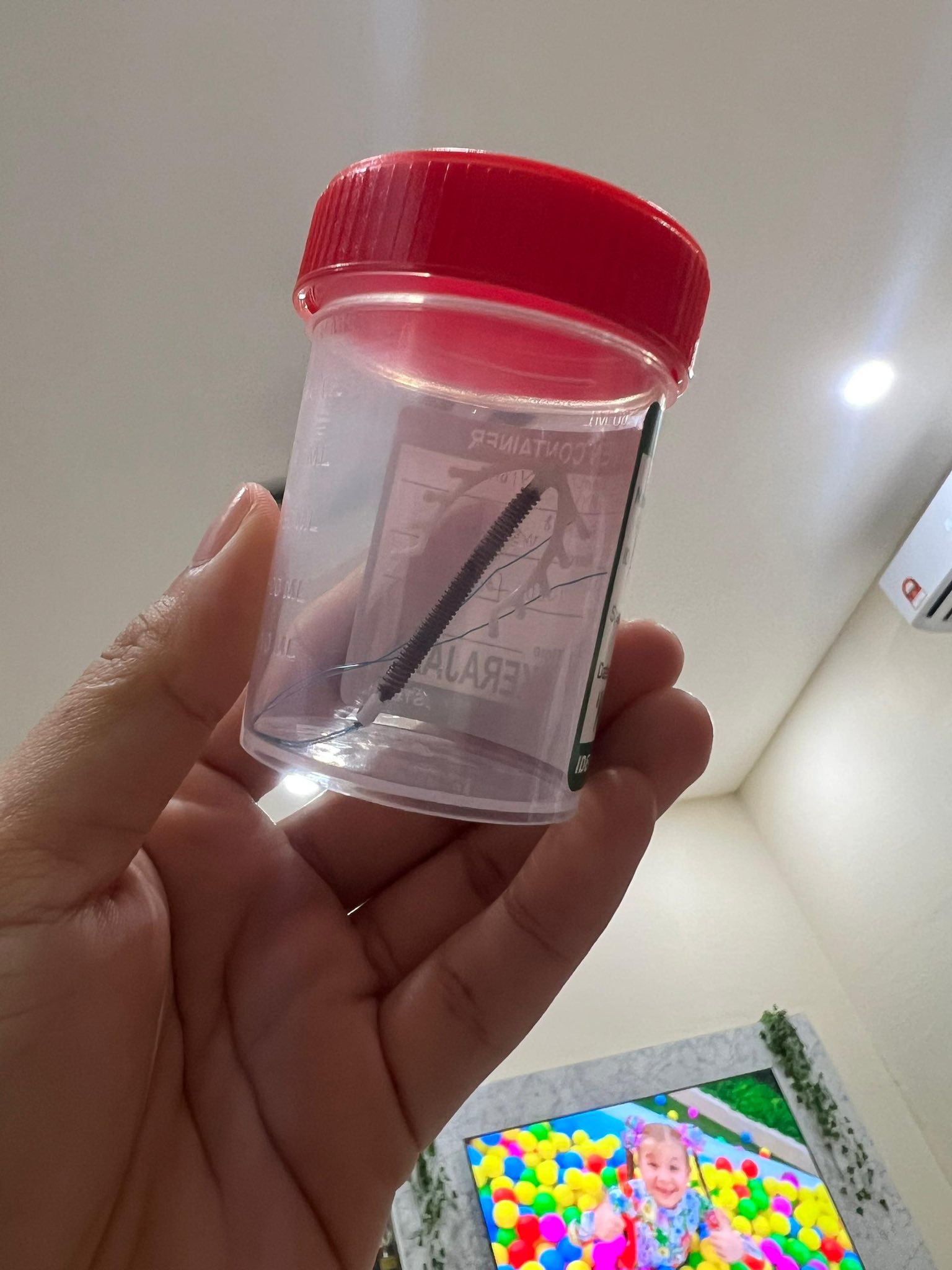 Doktor Salah Pasang IUCD Hingga Tembus Rahim, Tak Boleh Beranak Normal Selamanya