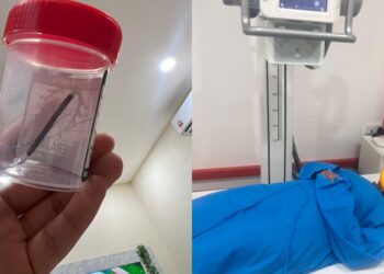 Doktor Salah Pasang IUCD Hingga Tembus Rahim, Tak Boleh Beranak Normal Selamanya