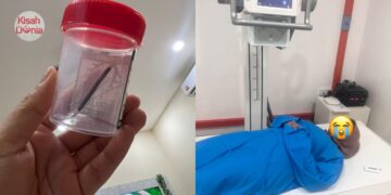 Doktor Salah Pasang IUCD Hingga Tembus Rahim, Tak Boleh Beranak Normal Selamanya