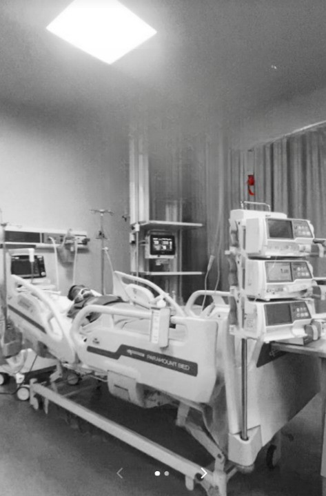 Isteri Picitkan Jerawat Hidung, Suami Meninggal Asbab Komplikasi Pembuluh Otak