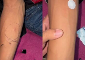 Langgan Perempuan Kerana Isteri Haid, Suami Kena ‘Kencing Panas’, Nanah Menitik