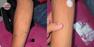 Langgan Perempuan Kerana Isteri Haid, Suami Kena ‘Kencing Panas’, Nanah Menitik