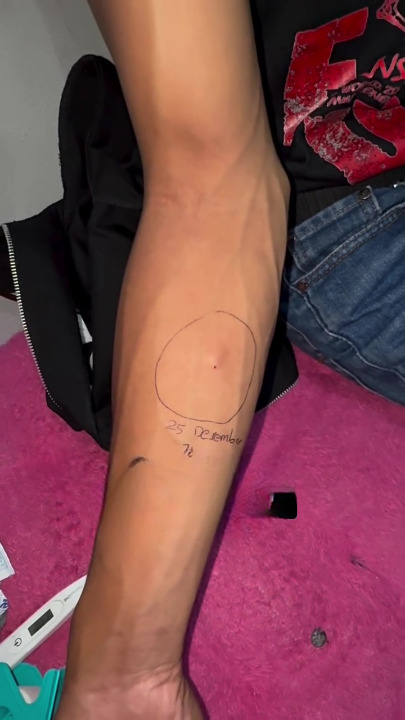 Langgan Perempuan Kerana Isteri Haid, Suami Kena ‘Kencing Panas’, Nanah Menitik