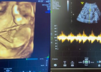 Langgan Perempuan Kerana Isteri Haid, Suami Kena ‘Kencing Panas’, Nanah Menitik