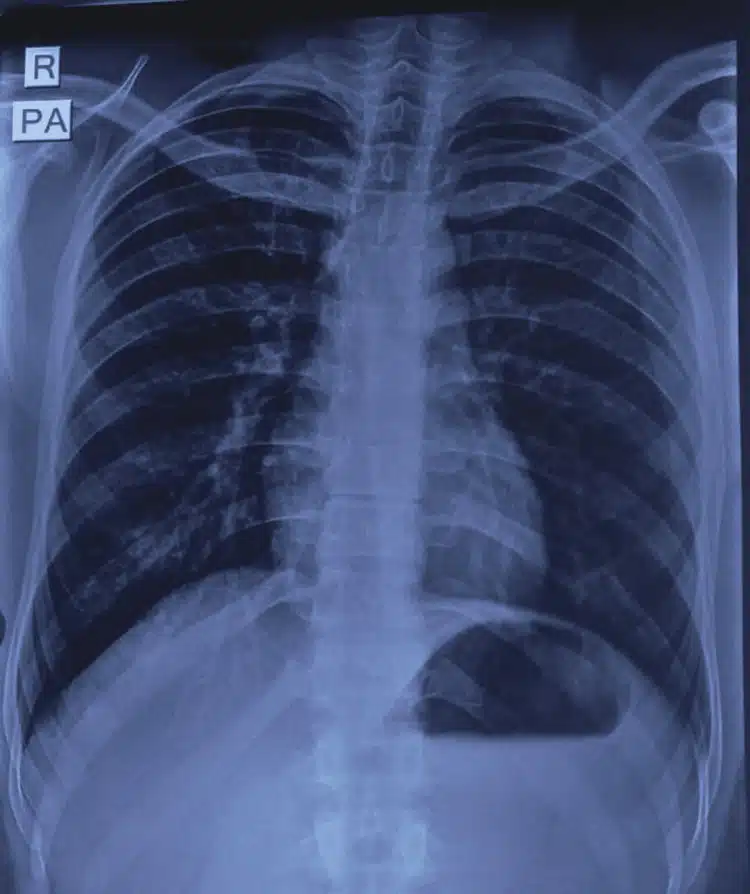 Lelaki Masukkan Paip Bidet Ke ‘Belakang’, Gagal Keluarkan Selepas Cuba Semalaman