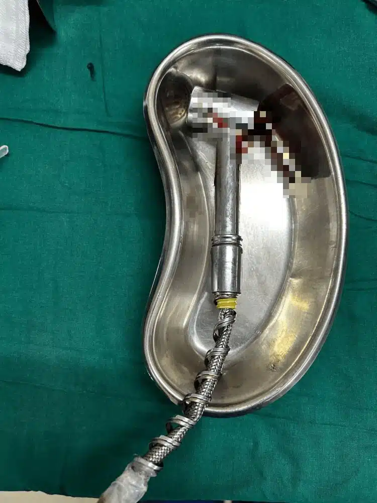 Lelaki Masukkan Paip Bidet Ke ‘Belakang’, Gagal Keluarkan Selepas Cuba Semalaman