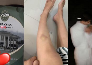 ‘Digilir’ Suspek Umur 10, 11 & 14 Tahun, Budak Perempuan Tidak Boleh Berjalan