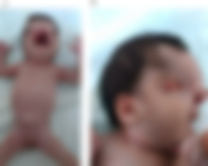 Angkara Nafsu Bapa, Anak 12 Tahun Lahirkan Bayi Cacat Melalui Czer