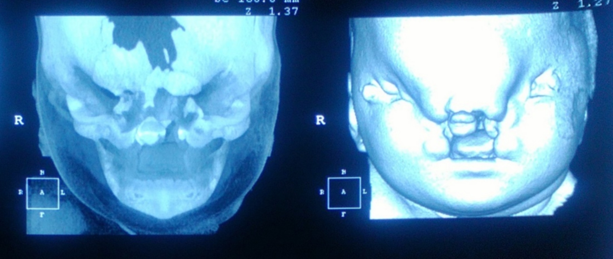 Angkara Nafsu Bapa, Anak 12 Tahun Lahirkan Bayi Cacat Melalui Czer