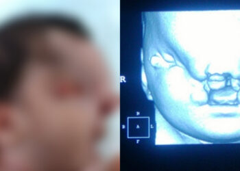 Gumpalan Tisu Ada Cecair Dijumpai, 2 Lelaki Lakukan Benda Tak Senonoh Ditahan