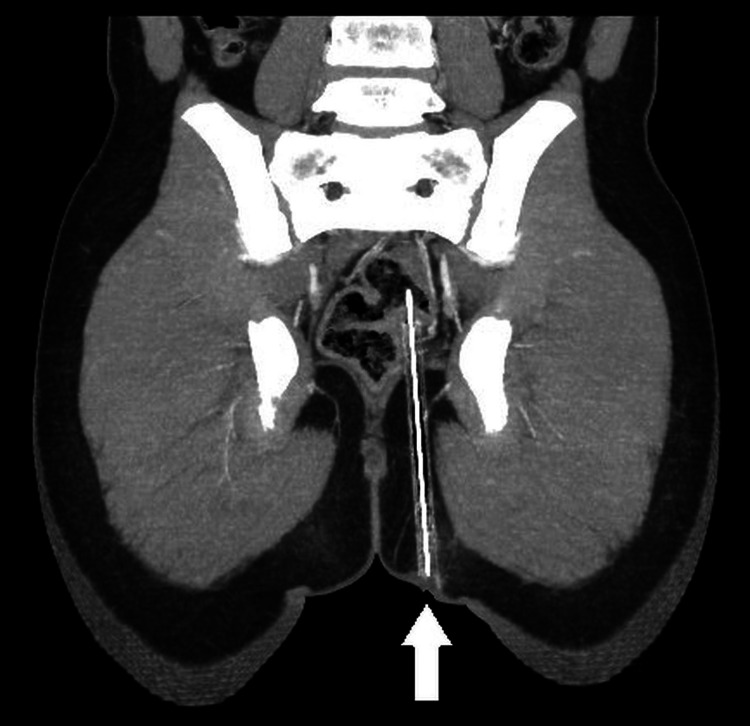 Kawan Prank Letak Pensel Tegak Atas Kerusi, Terduduk & ‘Termasuk’ Sedalam 12.4CM