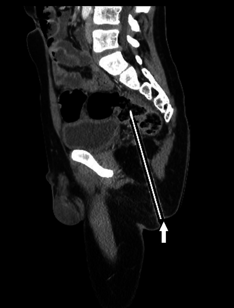 Kawan Prank Letak Pensel Tegak Atas Kerusi, Terduduk & ‘Termasuk’ Sedalam 12.4CM
