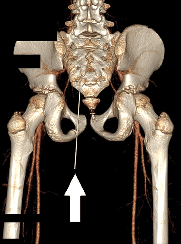 Kawan Prank Letak Pensel Tegak Atas Kerusi, Terduduk & ‘Termasuk’ Sedalam 12.4CM