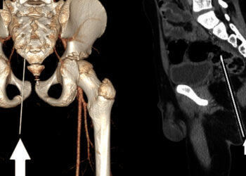 Gumpalan Tisu Ada Cecair Dijumpai, 2 Lelaki Lakukan Benda Tak Senonoh Ditahan