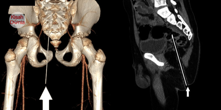 Kawan Prank Letak Pensel Tegak Atas Kerusi, Terduduk & ‘Termasuk’ Sedalam 12.4CM