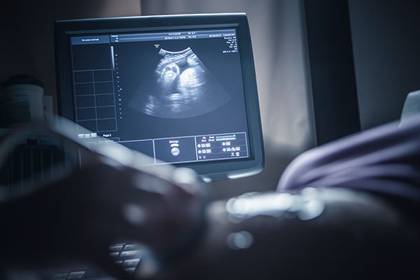 Pelajar Tingkatan 3 Hamil 6 Bulan, Kawan Lain Juga ‘Buat’ Namun Tak Mengandung