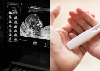 Wanita Bangga Anak Dapat Kewarganegaraan UK, Diarah Bayar Balik Semua Biasiswa