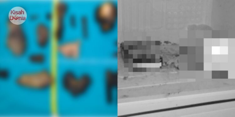 Ibu Dianiaya Anak, Serat Ditemui Dalam Najis – “Direbus, Dipanggang & Dimakan”