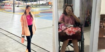 Kuat Minum Kopi Hingga Terlupa Air Putih, Wanita 28 Tahun Alami Lumpuh