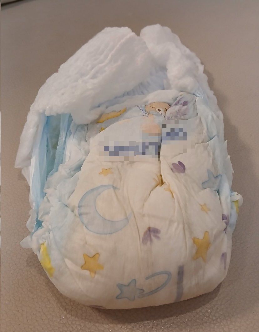 “Dia Bukan Autisme, UPKK Pun 9A” – Remaja Berusia 13 Tahun Gemar Pakai Lampin