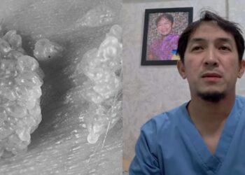 Anak Demam Panas Kerana Rindu, Pengasuh ‘Amma Appa’ Naik Motor Redah Hujan Lebat