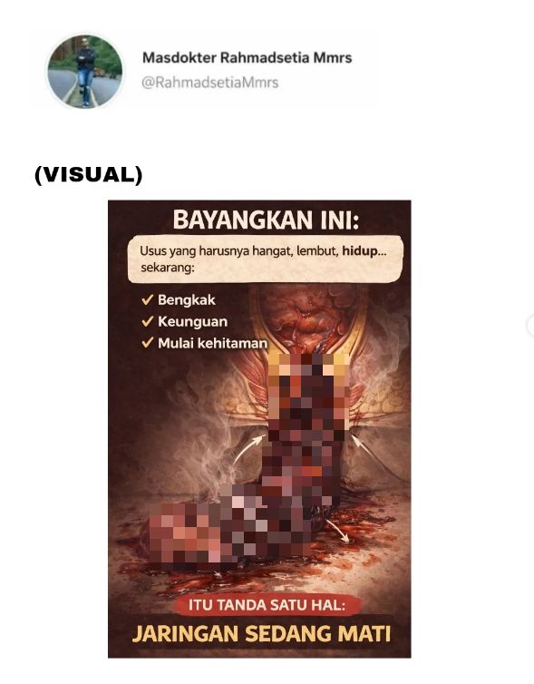 40cm Usus Keluar Akibat ‘Hubungan Belakang’, Hilang Upaya Buang Air Besar