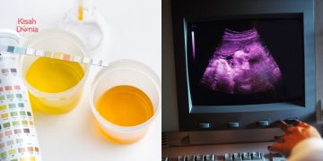 Budak 8 Tahun Hamil 8 Bulan, Sampel Air Ketuban Akhirnya Bongkar Pelaku Sebenar