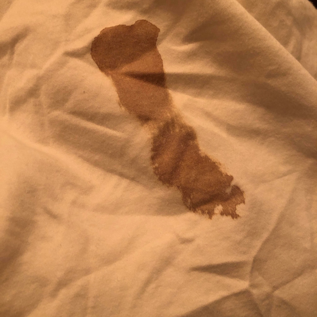 Pemuda 18 Tahun Cemas Alami Haid Banyak, Sisi Gelap Akhirnya Terbongkar