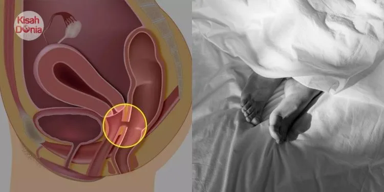 Kerap Berhubungan Luar Tabii, Najis Isteri Keluar Ikut ‘Depan’…Suami Menyesal